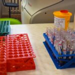 Больше возможностей для лечения пациентов от гепатита С появилось в Новосибирской области